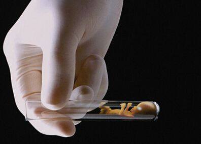 供卵代怀生男宝代生包成功